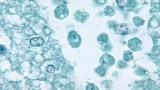 Naegleria fowleri