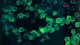 Naegleria fowleri