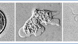 Naegleria fowleri